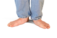 Identifying the Signs and Symptoms of Flat Feet