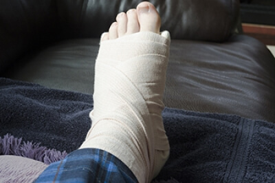 Recovery Process for a Broken Foot