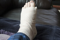 Children’s Foot Fractures