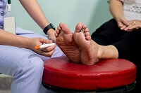 When Neuropathy Affects the Feet