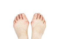 How Wide Feet Can Cause Pain