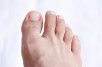 Growth of Toenails