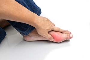 Gout&#039;s Impact on Foot Health